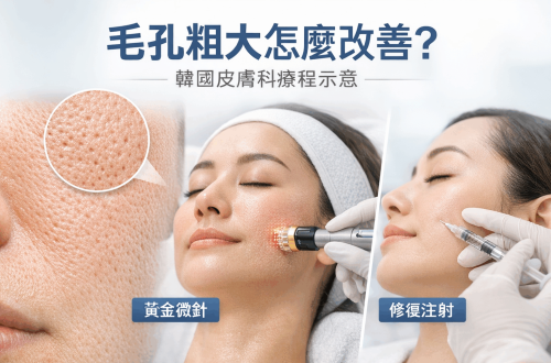毛孔粗大怎麼改善？韓國皮膚科常見療程與真實效果解析缩略图